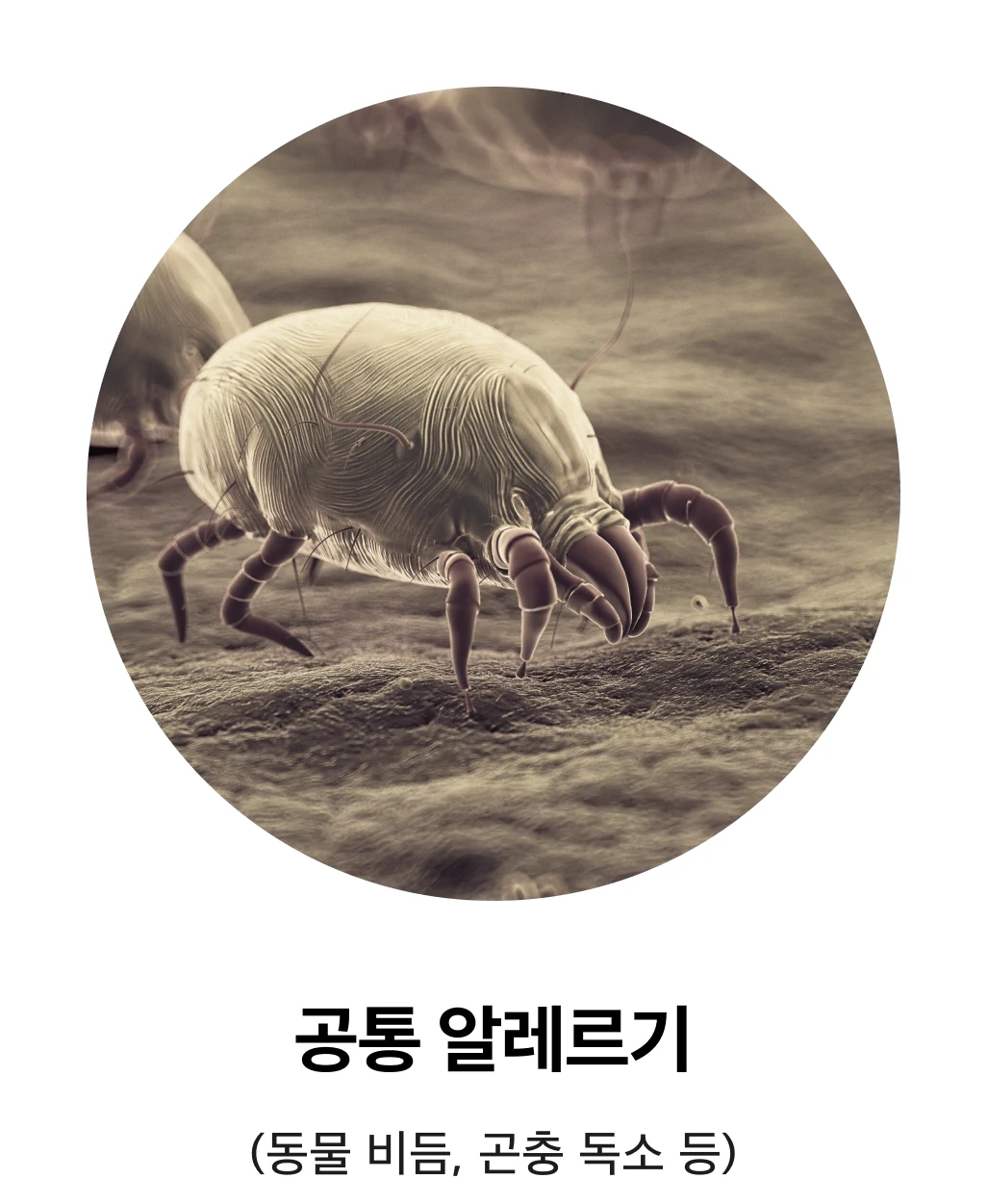 공통 알레르기: 동물 비듬, 곤충 독소 등