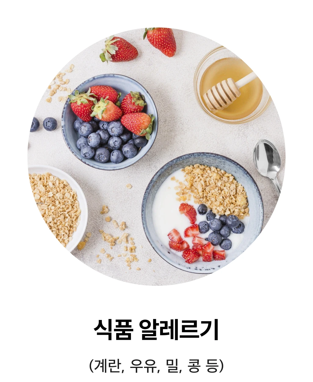 식품 알레르기: 계란, 우유, 밀, 콩 등